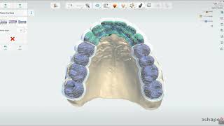 Welcome to 3Shape Splint Studio