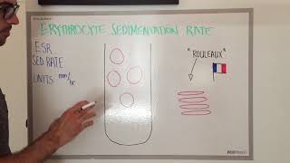 Erythrocyte Sedimentation Rate: Explained