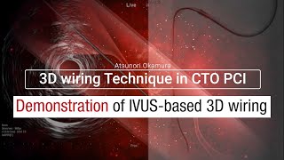 【Japanese】Demonstration of IVUS-based  3D wiring