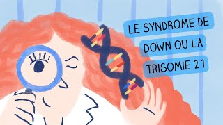 Mécanismes génétiques - Trisomie 21 / Syndrome de Down