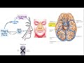 dangerous area of the face explained thrombosis of cavernous sinus anatomy u0026 clinical risks acne