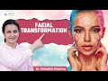 Transform Your Face in Minutes! | Facial Contouring/Aesthetics Treatments in Delhi | Aestiva Clinic