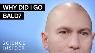Why Some Men Go Bald