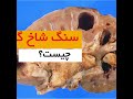 سنگ شاخ گوزنی دکتر سید امین میرصادقی