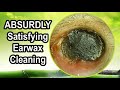 ABSURDLY Satisfying Earwax Cleaning With Relaxing Sound