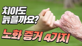 치아도 나이를 먹나요? 치아도 노화가 될까요? 노화 지표 노화 증거 4가지ㅣ수원 김기록치과