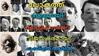 First plastic surgery in world history ലോക ചരിത്രത്തിലെ ആദ്യ പ്ളാസ്റ്റിക് സർജറി malayalam Hospitorus