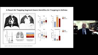 2024.03.08 Mass General Brigham Asthma Grand Rounds