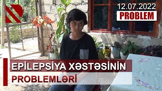 Problem: Epilepsiya xəstəsinin problemləri – 12.07.2022