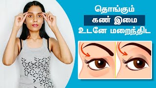 Easy Exercises For Droopy Eyelids | தொங்கும் கண் இமையா கவலையா விடுங்க