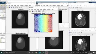 Brain Tumor detection using Matlab || machine learning