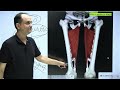 femoral artery anatomy 3d origin course branches and relations