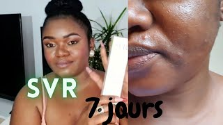 SVR: GEL EFFICACITÉ EN 7 JOURS . Boutons , tâches, acnés, imperfections sébum