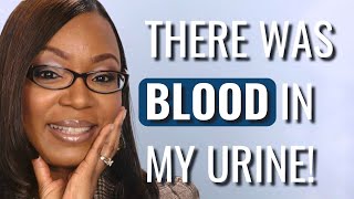 I Thought My UTIs Were Normal - It Was CANCER! - Monica | Bladder Cancer | The Patient Story