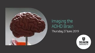 Webinar: Imaging the ADHD Brain