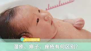 小儿湿疹、宝宝痱子、宝宝痤疮有什么区别？