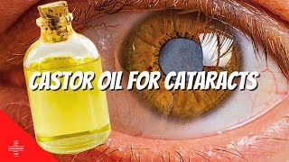 Castor Oil for Cataracts : Can YOU use it ?