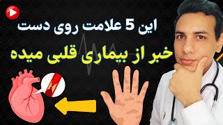 تشخیص بیماری قلبی از روی علائم روی دست | Diagnosing heart disease from symptoms on the hand