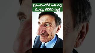 ⚡ప్రపంచంలోనే అతి పెద్ద ముక్కు కలిగిన వ్యక్తి | #Shorts | Top Interesting Telugu Facts