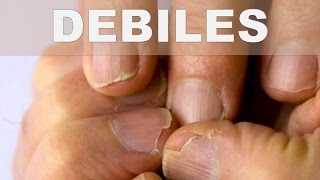 remedio casero para endurecer las uñas débiles