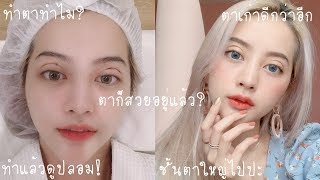 เมื่อฉันไปทำตา2ชั้นมา👁💖