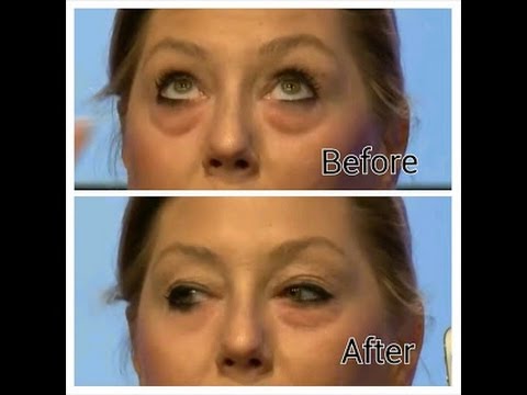 Instantly Ageless Eye Lift Cream Youtube