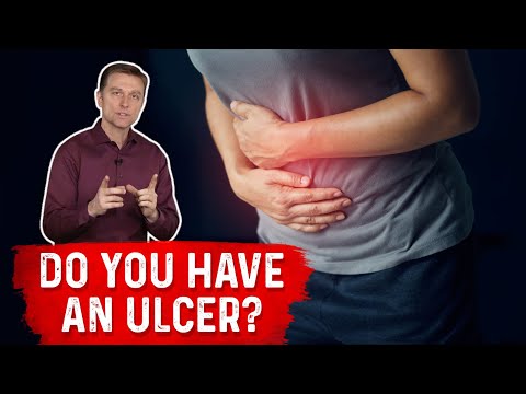 Ulcers: How Do You Know If You Have One? Ulcers: How Do You Know If You Have One?