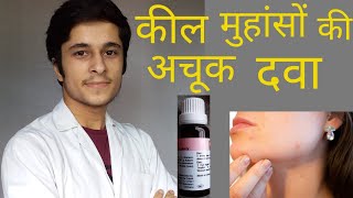 r53 Best HOMEOPATHIC MEDICINE For ACNE PIMPLE On Face!