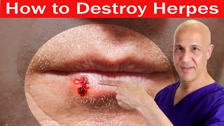 How to Destroy HERPES | Dr. Mandell