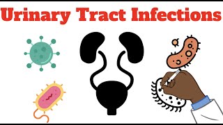 The MOST Common Bacterial Infection - Urinary Tract Infections (UTI) Causes, Diagnosis, Treatment