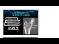 classifications of fracture neck of femur