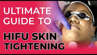 Ultimate Guide to HIFU Skin Tightening | HIFU Procedure @sakhiyaskinclinic