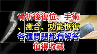 骨折後復位、手術、癒合、功能恢復，各種問題都有解答，值得收藏