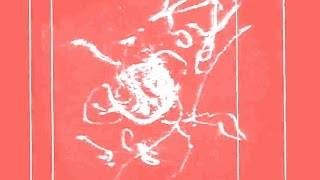 Dislocations interacting with precipitate - tomogram