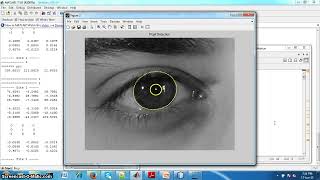 Iris Recognition using Cumulative SUM based Change Analysis
