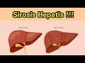 SIROSIS HEPATIS -  Gejala, Penyebab, Makanan yang dianjurkan & Tidak dianjurkan, dan Pencegahan