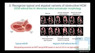 Current Strategies In Diagnosis And Management Of Hypertrophic Cardiomyopathy