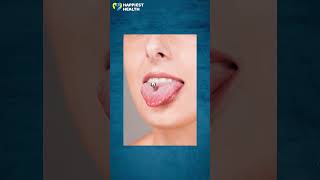 Tongue piercing and oral health