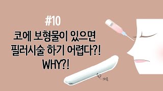 [쉽게알아보는필러] #코필러 궁금해요! 코에 보형물이 있을 때 어려운 필러시술 효과를 보려면?!