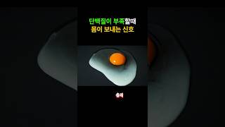 단백질이 부족하면 이 증상이 나타나요 #건강 #건강정보 #단백질