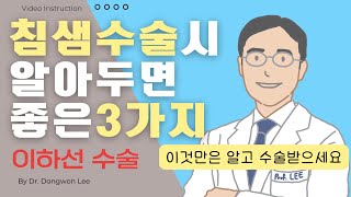 침샘 수술시 알아두면 좋은 3가지 (이하선 수술, 이비인후과 이동원 교수) #침샘수술 #이하선 #침샘 #이하선종물 #이하선혹 #침샘혹 #침샘암 #이하선수술