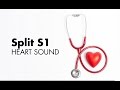 Split S1 - Heart Sounds - MEDZCOOL