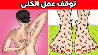 7 علامات غريبة لمشاكل الكلى يجب أن تعرفها! 😱💧 | كيف تحافظ على صحة كليتيك 🧑‍⚕️💪