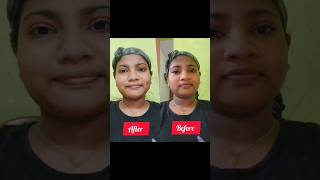 ഒറ്റ യൂസിൽ കിട്ടിയ result 😯😱 #facemask #viral #trending #korean #tips