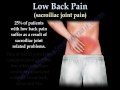 Sacroiliac Joint pain and dysfunction - Everything You Need To Know - Dr. Nabil Ebraheim, M.D.