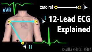 12 Lead ECG Explained, Animation