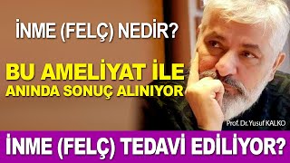 İnme (Felç) Tedavi Edilebilir... İşte Detaylar...  | Prof. Dr. Yusuf KALKO