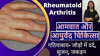 आमवात और आयुर्वेदिक चिकित्सा-सम्पूर्ण जानकारी, Rheumatoid Arthritis \u0026 Ayurveda-Prevention \u0026 cure