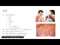 医痴说病 山谷热 （valley fever）－中国交流学者邓勇先生因为新冠不幸去世，但是他入院的原因是山谷热。今天我介绍一下这个病以及治疗和预防。