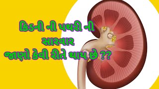 કિડની ની પથરી ની સારવાર કેવી રીતે થાય છે તે જાણો || treatment of kidney stone || treatment ||